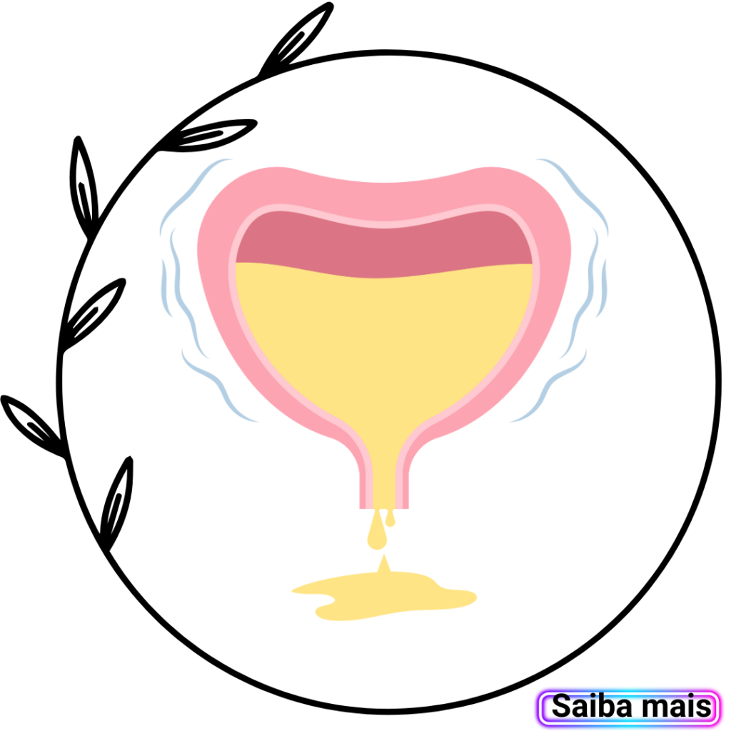 Imagem de incontinência urinária feminina