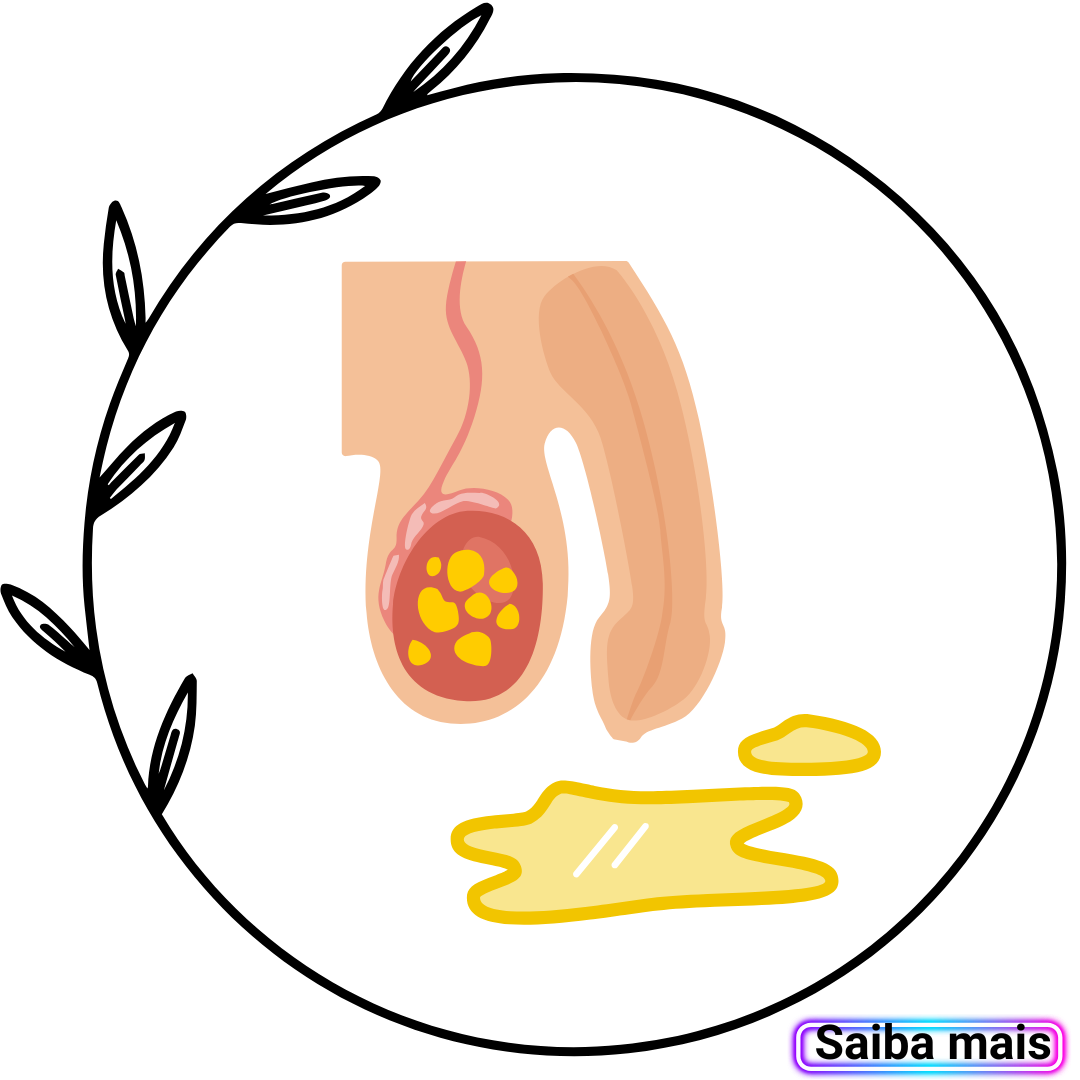 imagem de incontinência urinária masculina